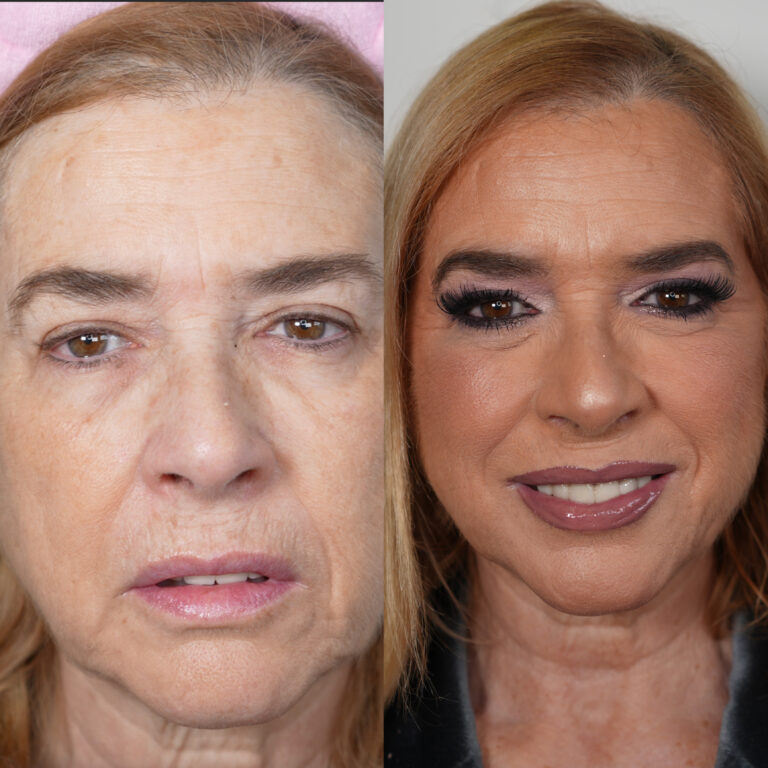Imagen del antes y después del curso de piel madura mixta. En el lado izquierdo vemos a una mujer sin maquillar. En la derecha, la misma mujer maquillada con la técnica del curso.